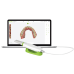 Scanner intraoral Infinity IS200